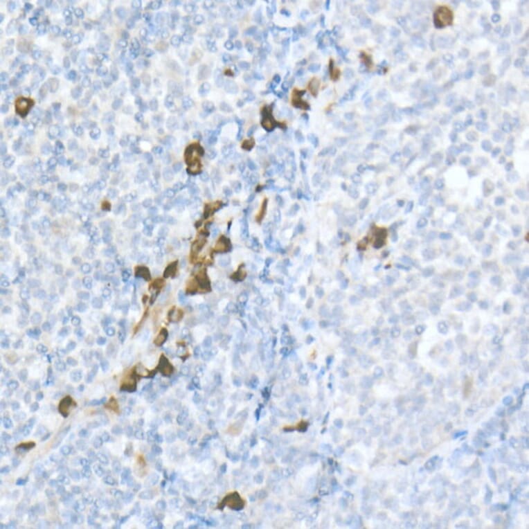 Immunohistochemistry - Anti-MDC Antibody (A16824) - Antibodies.com