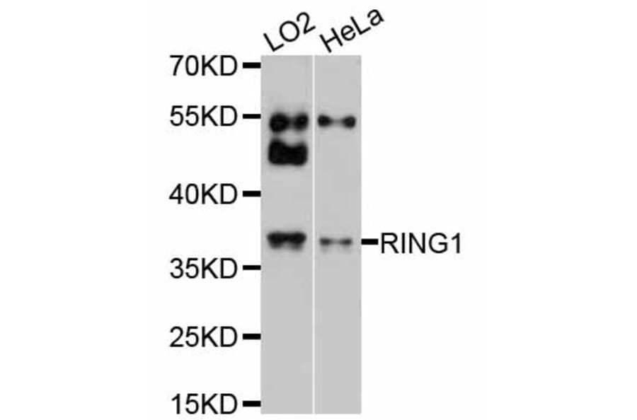 Western Blot - Anti-RING1 Antibody (A2231) - Antibodies.com