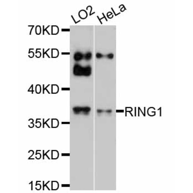 Western Blot - Anti-RING1 Antibody (A2231) - Antibodies.com
