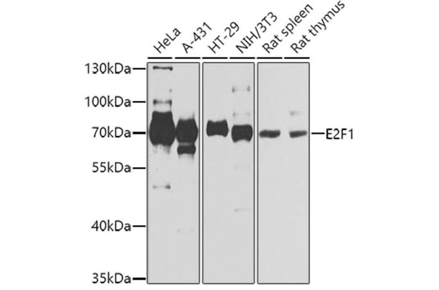 Western Blot - Anti-E2F1 Antibody (A2442) - Antibodies.com