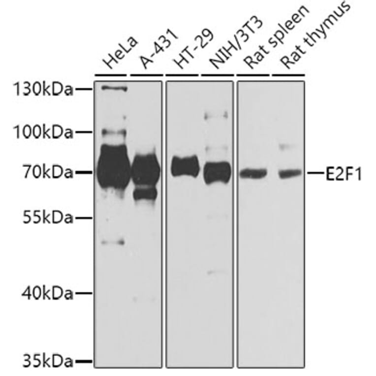 Western Blot - Anti-E2F1 Antibody (A2442) - Antibodies.com