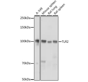 Western Blot - Anti-TLR2 Antibody (A16828) - Antibodies.com