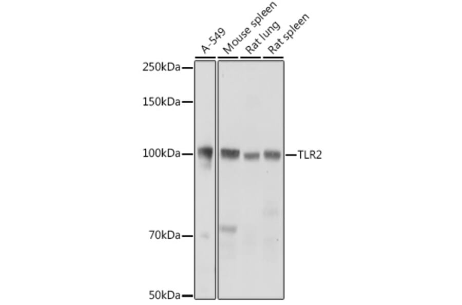 Western Blot - Anti-TLR2 Antibody (A16828) - Antibodies.com