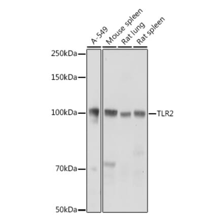 Western Blot - Anti-TLR2 Antibody (A16828) - Antibodies.com