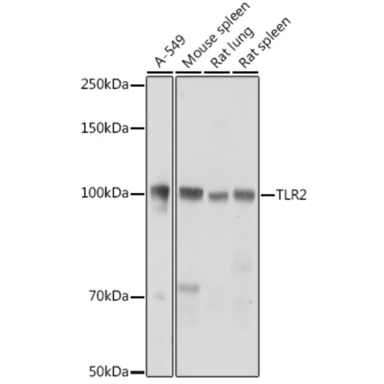 Western Blot - Anti-TLR2 Antibody (A16828) - Antibodies.com