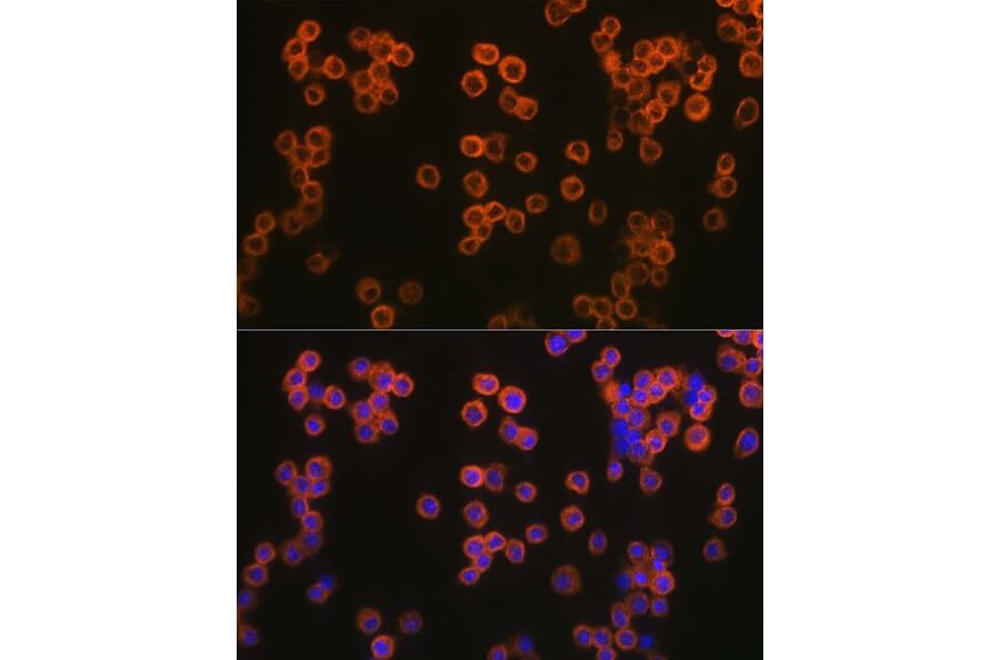 Immunofluorescence - Anti-TLR2 Antibody (A16828) - Antibodies.com