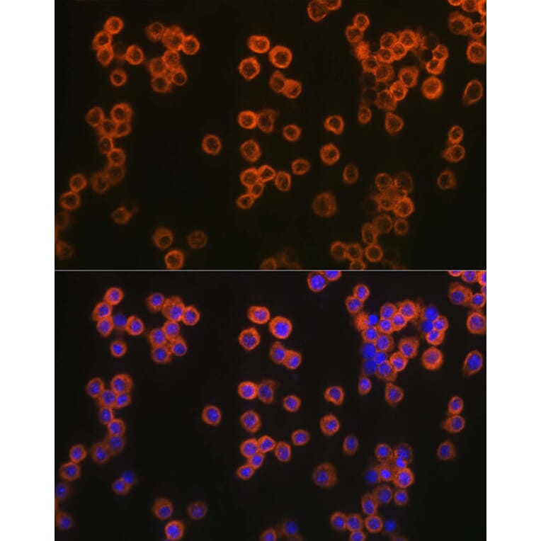 Immunofluorescence - Anti-TLR2 Antibody (A16828) - Antibodies.com