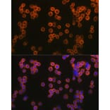 Immunofluorescence - Anti-TLR2 Antibody (A16828) - Antibodies.com