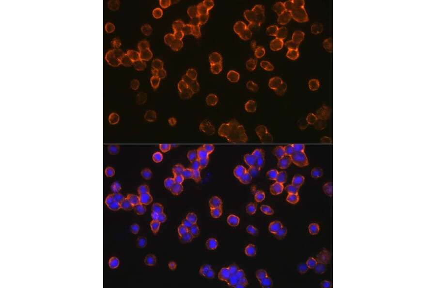 Immunofluorescence - Anti-TLR2 Antibody (A16828) - Antibodies.com