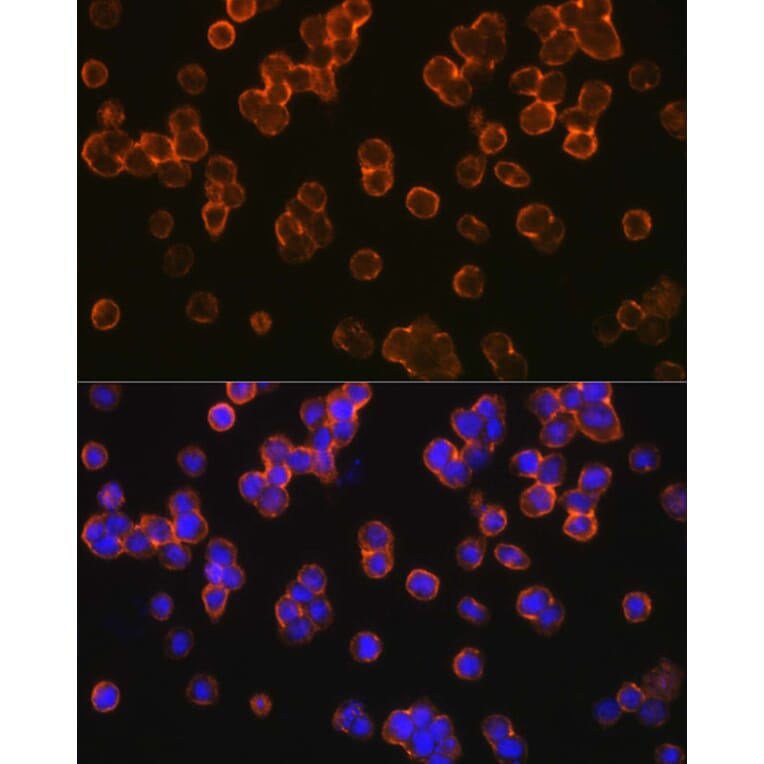 Immunofluorescence - Anti-TLR2 Antibody (A16828) - Antibodies.com