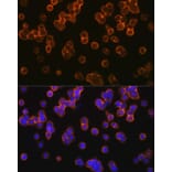 Immunofluorescence - Anti-TLR2 Antibody (A16828) - Antibodies.com