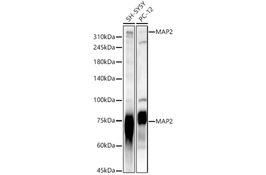 Western Blot - Anti-MAP2 Antibody (A16829) - Antibodies.com