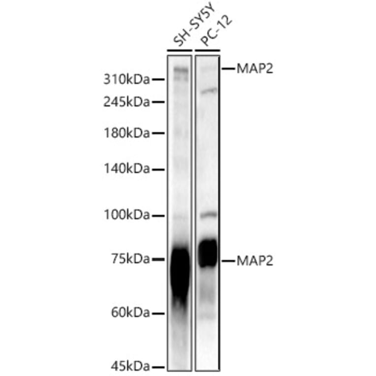 Western Blot - Anti-MAP2 Antibody (A16829) - Antibodies.com