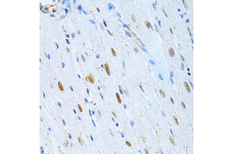 Immunohistochemistry - Anti-MAP2 Antibody (A16829) - Antibodies.com