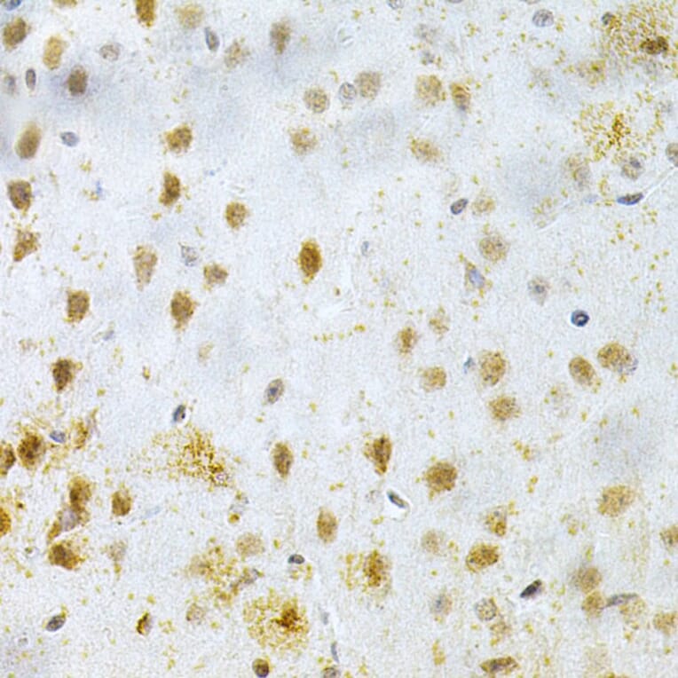 Immunohistochemistry - Anti-MAP2 Antibody (A16829) - Antibodies.com