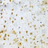 Immunohistochemistry - Anti-MAP2 Antibody (A16829) - Antibodies.com