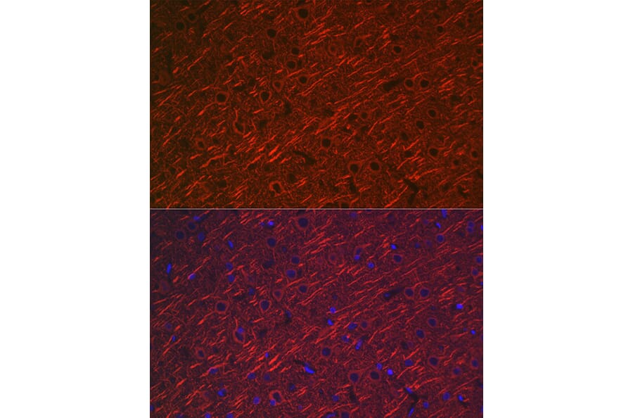 Immunofluorescence - Anti-MAP2 Antibody (A16829) - Antibodies.com
