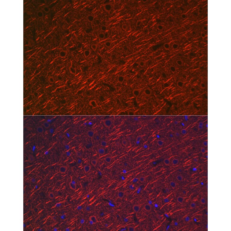 Immunofluorescence - Anti-MAP2 Antibody (A16829) - Antibodies.com