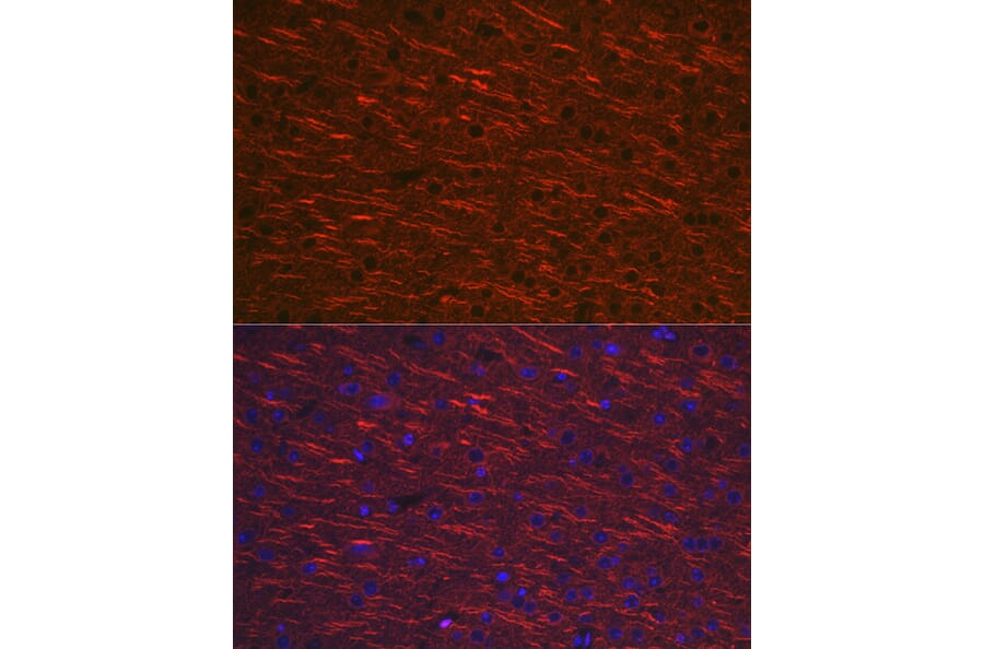 Immunofluorescence - Anti-MAP2 Antibody (A16829) - Antibodies.com