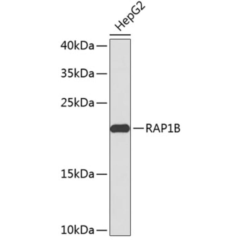 Western Blot - Anti-RAP1B Antibody (A2665) - Antibodies.com