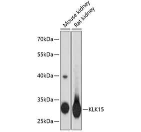 Western Blot - Anti-Kallikrein Antibody (A16831) - Antibodies.com