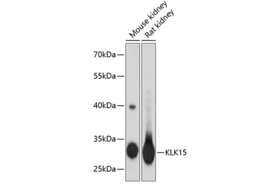 Western Blot - Anti-Kallikrein Antibody (A16831) - Antibodies.com