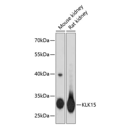 Western Blot - Anti-Kallikrein Antibody (A16831) - Antibodies.com