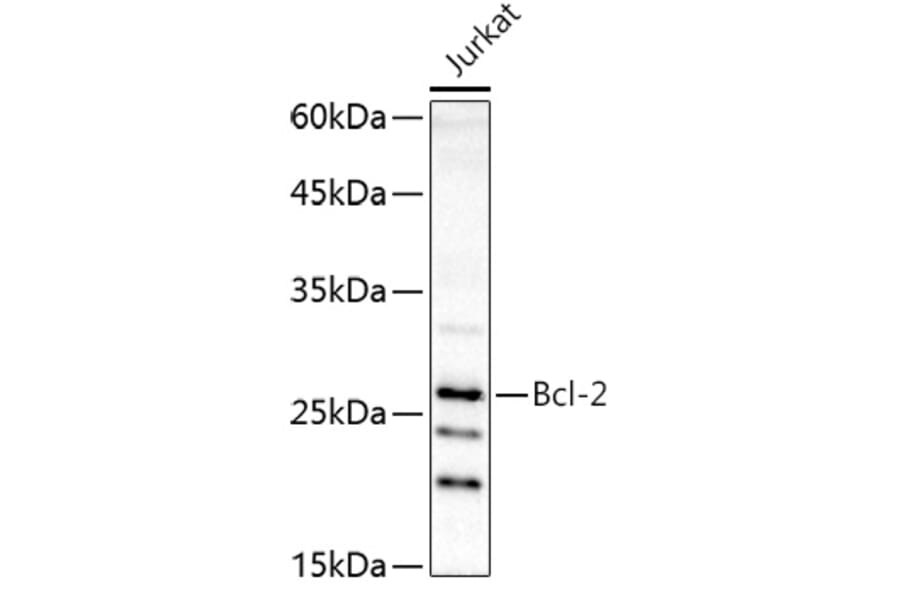 Western Blot - Anti-Bcl-2 Antibody (A16833) - Antibodies.com