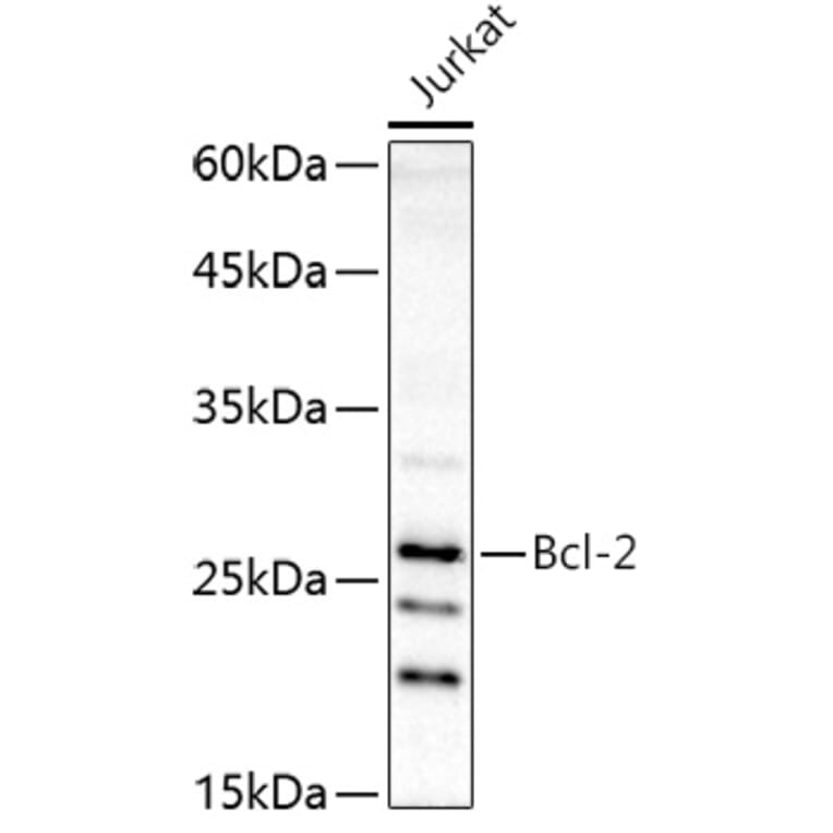 Western Blot - Anti-Bcl-2 Antibody (A16833) - Antibodies.com