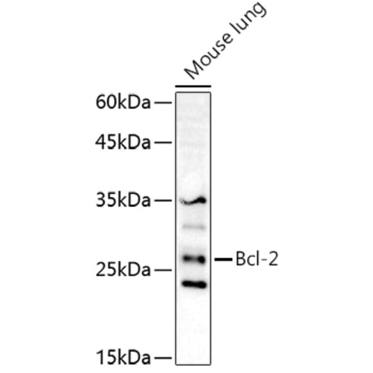 Western Blot - Anti-Bcl-2 Antibody (A16833) - Antibodies.com