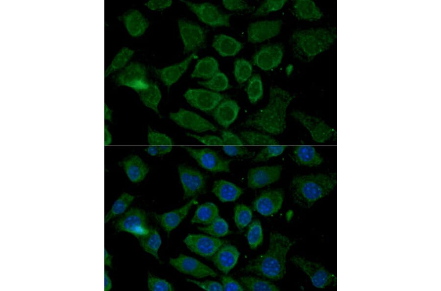Immunofluorescence - Anti-Bcl-2 Antibody (A16833) - Antibodies.com