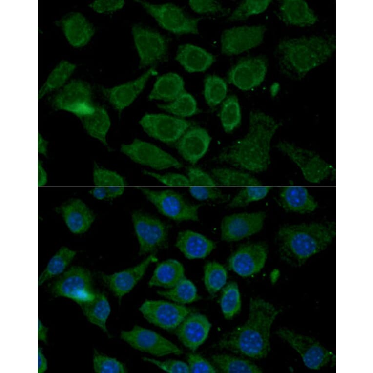 Immunofluorescence - Anti-Bcl-2 Antibody (A16833) - Antibodies.com