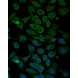 Immunofluorescence - Anti-Bcl-2 Antibody (A16833) - Antibodies.com
