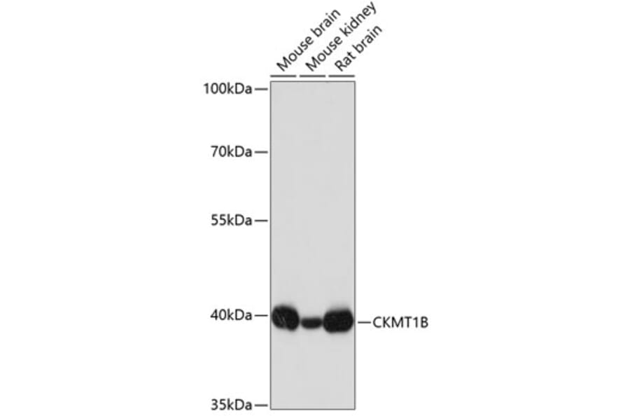 Western Blot - Anti-Creatine kinase MT Antibody (A16834) - Antibodies.com