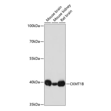 Western Blot - Anti-Creatine kinase MT Antibody (A16834) - Antibodies.com