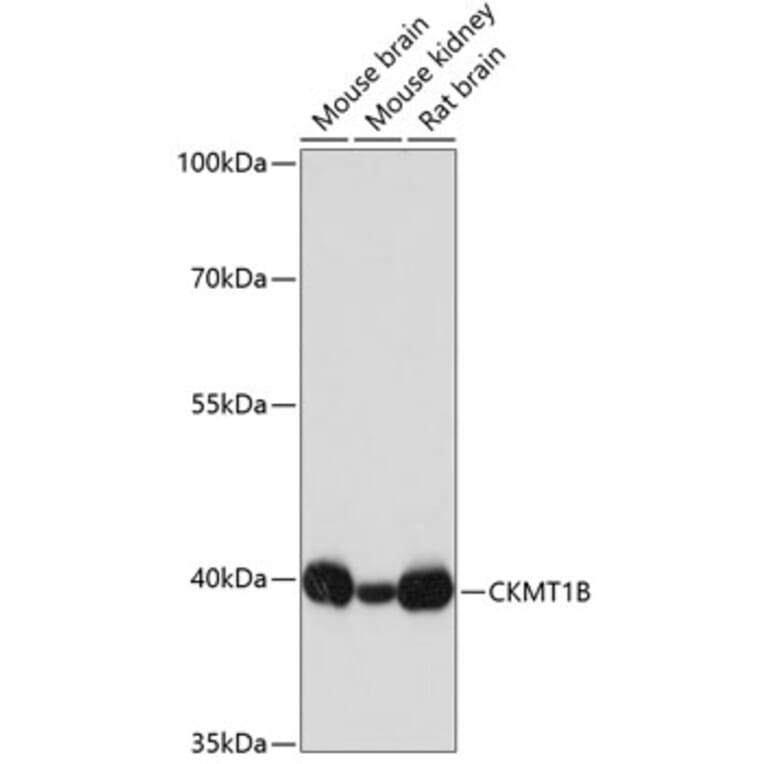 Western Blot - Anti-Creatine kinase MT Antibody (A16834) - Antibodies.com