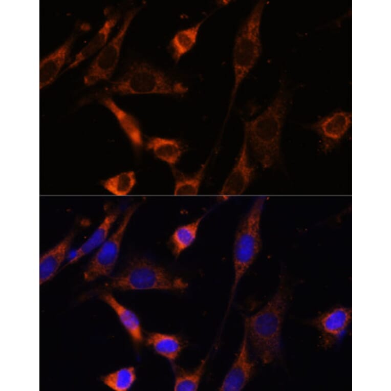 Immunofluorescence - Anti-Creatine kinase MT Antibody (A16834) - Antibodies.com
