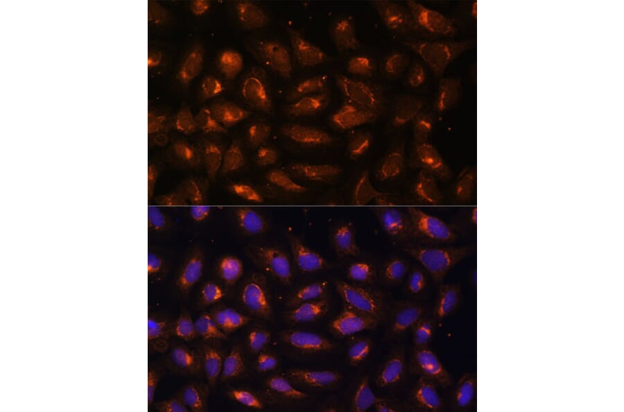 Immunofluorescence - Anti-Creatine kinase MT Antibody (A16834) - Antibodies.com