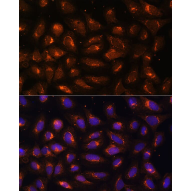 Immunofluorescence - Anti-Creatine kinase MT Antibody (A16834) - Antibodies.com