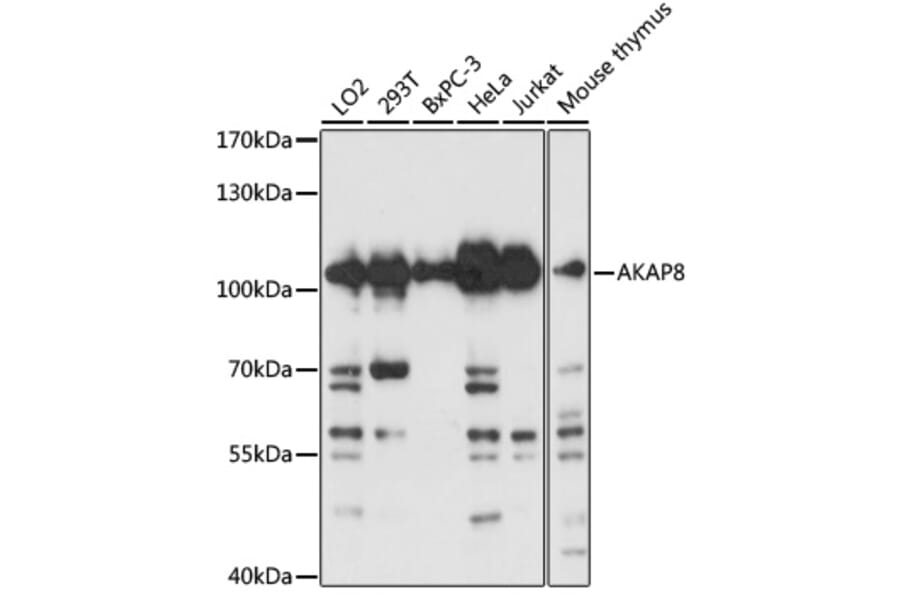 Western Blot - Anti-AKAP 95 Antibody (A16835) - Antibodies.com
