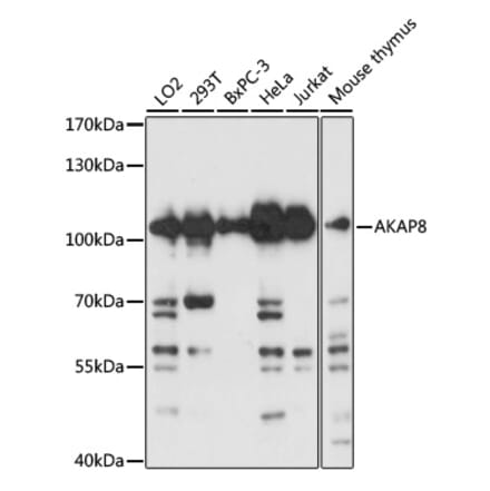 Western Blot - Anti-AKAP 95 Antibody (A16835) - Antibodies.com