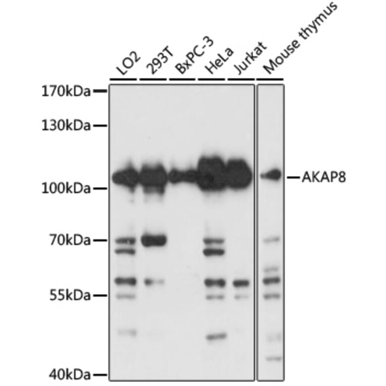 Western Blot - Anti-AKAP 95 Antibody (A16835) - Antibodies.com