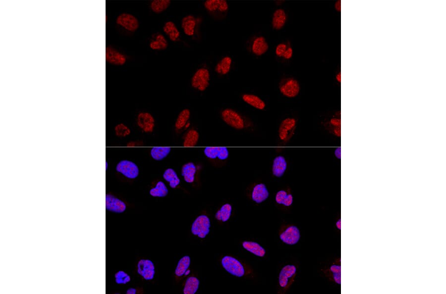 Immunofluorescence - Anti-AKAP 95 Antibody (A16835) - Antibodies.com