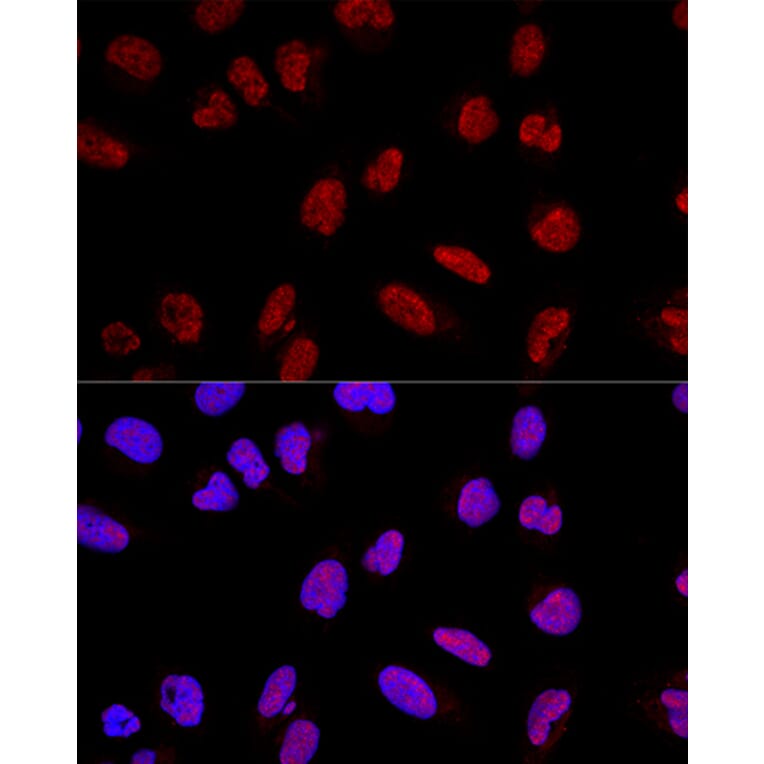 Immunofluorescence - Anti-AKAP 95 Antibody (A16835) - Antibodies.com