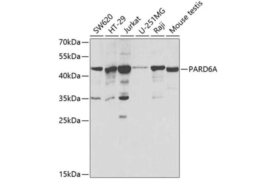 Western Blot - Anti-PAR6 Antibody (A16836) - Antibodies.com