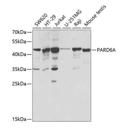 Western Blot - Anti-PAR6 Antibody (A16836) - Antibodies.com