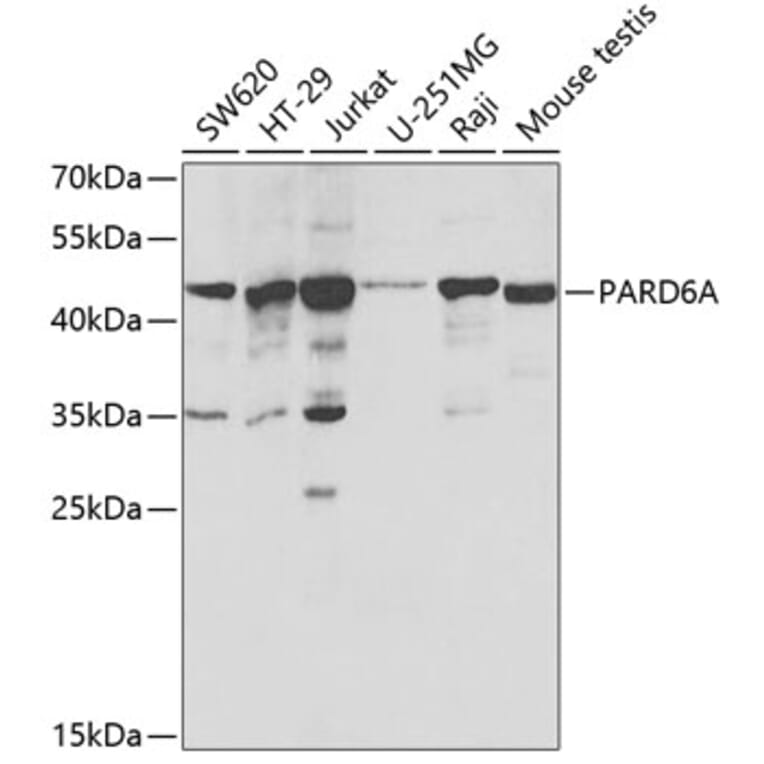 Western Blot - Anti-PAR6 Antibody (A16836) - Antibodies.com