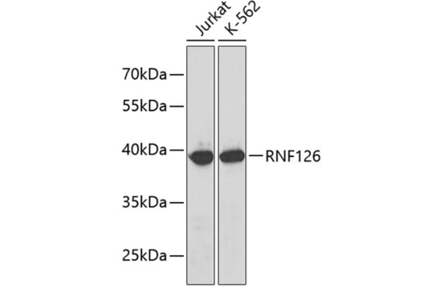 Western Blot - Anti-RNF126 Antibody (A3081) - Antibodies.com