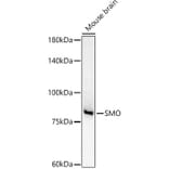 Western Blot - Anti-Smoothened Antibody (A16839) - Antibodies.com