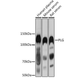 Western Blot - Anti-Plasminogen Antibody (A16840) - Antibodies.com